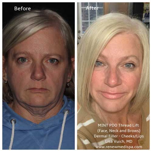 Kelly-Multi-Procedure-qczk0qk1kl7d9xoiycgjsa2p7sbvbxbktzj5dhk7m0